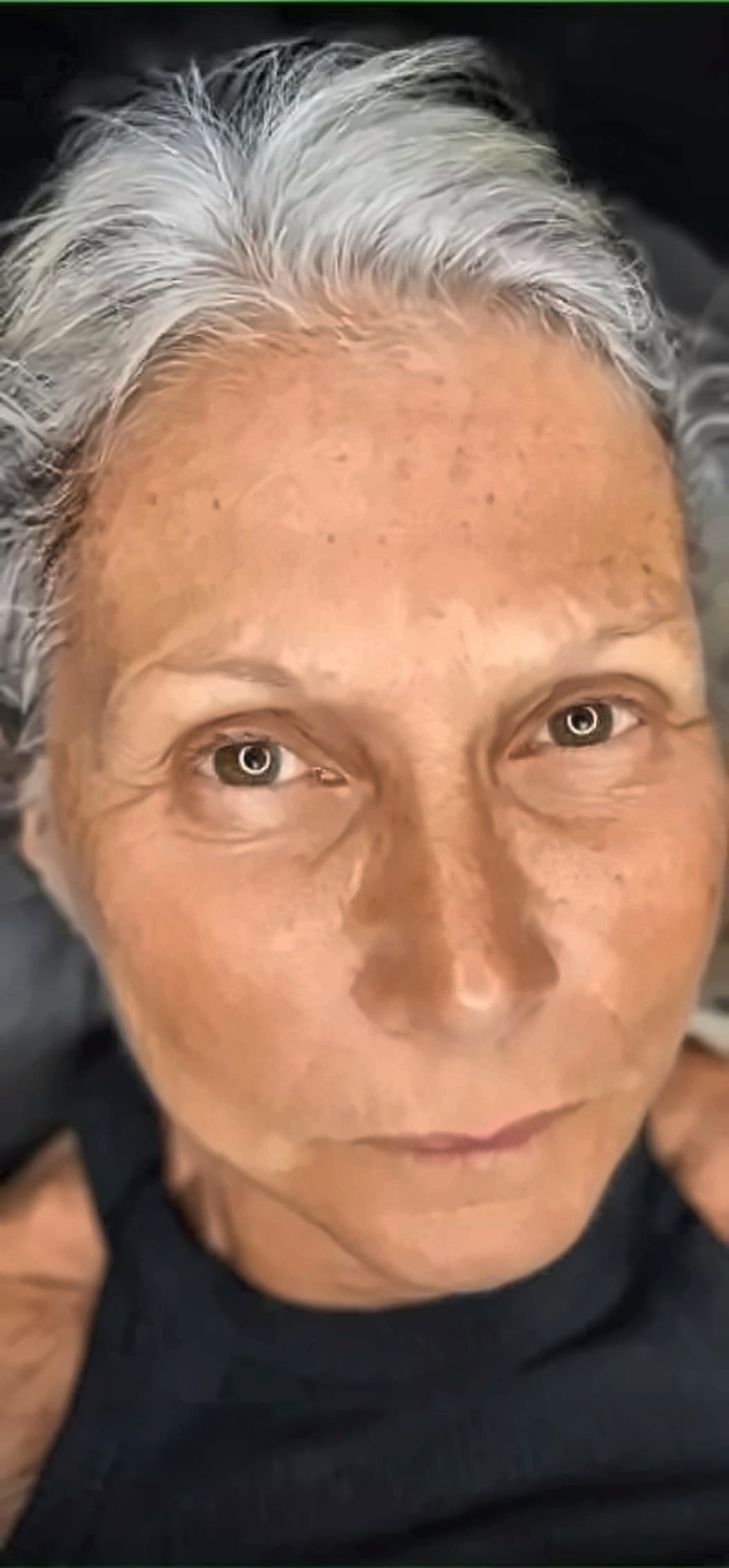 גבות דלילות לפני טיפול